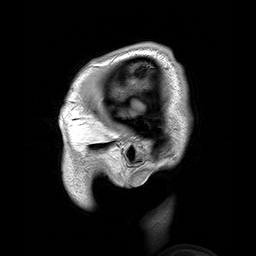 Magnetic resonance imaging(MRI), Dwayne Reed